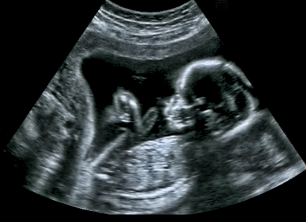 Baby Amina memory 2